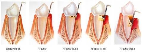 牙齿疾病的区分及检查项目？
