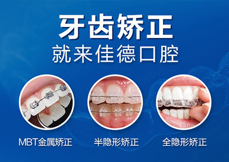 牙齿矫正需要注意什么