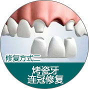修复方式
