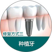 修复方式